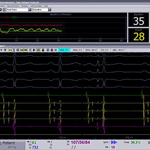 product-product-categories-interventional-x-ray-igs-for-ep-assess-ep-ablation.jpg