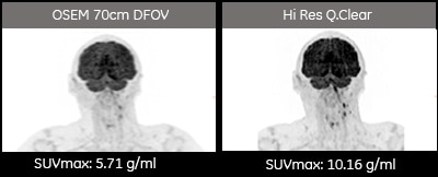 product-product-categories-molecular-imaging-discovery mi -new-small lesion 1.png