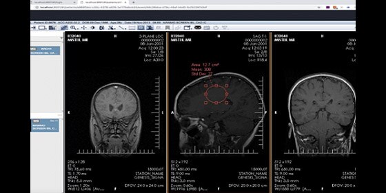 How digital imaging could improve tumor boards