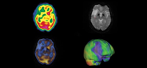 NM CT 870 CZT | GE Healthcare