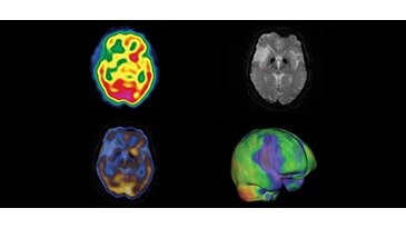 NM CT 870 CZT | GE Healthcare