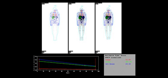 NM CT 870 CZT | GE Healthcare