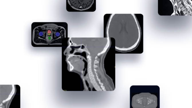 Selection of scans and medical imagery 