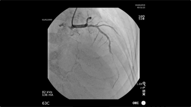 C arms for Cardiac Imaging GE HealthCare United Kingdom