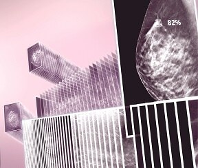 ProFound AI™ by iCAD for Senographe Pristina