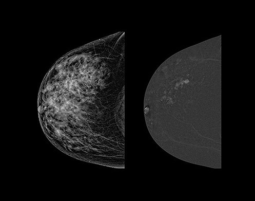 BoothMap H SenoBright