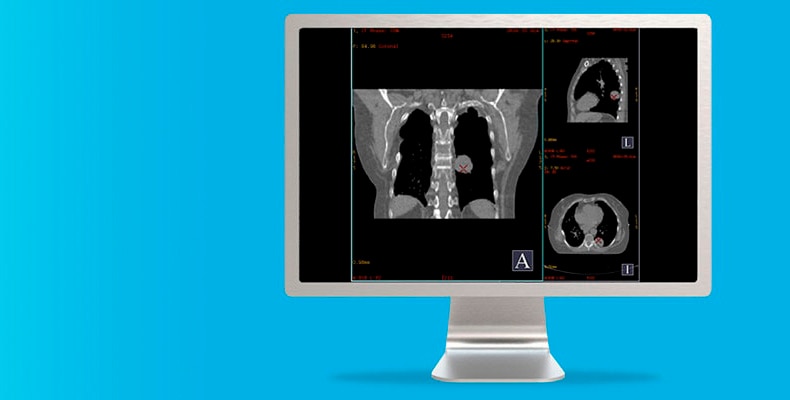 44562-education-course-PET-CT1