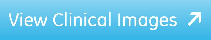 -product-categories-ultrasound-new logiq e-gehc-new-logiqe-view-clinical-images_button.jpg
