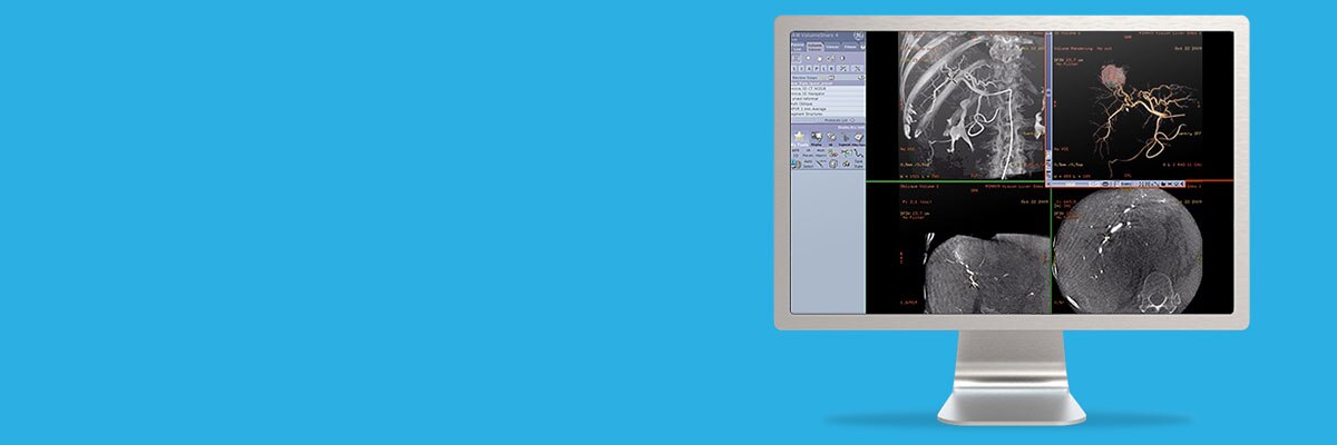 ries-do-not-clone-advanced-visualization-applications-innova 3d-aw-innova-3d_spotlight.jpg