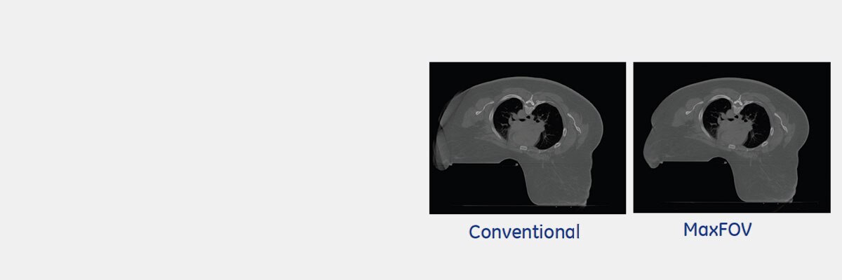 product-product-categories-computed-tomography-radiation therapy-main.png
