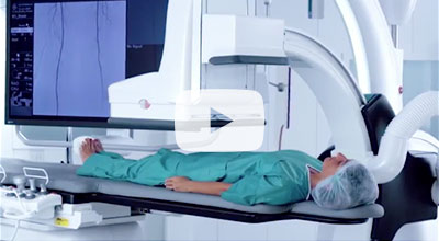 Discovery IGS 740 extended coverage in 2D