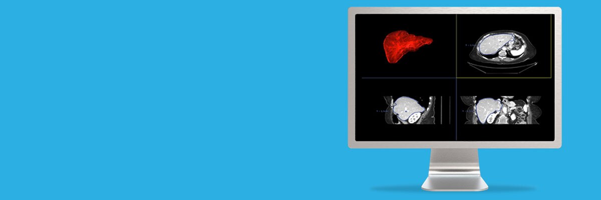 o-not-clone-advanced-visualization-applications-hepatic-vcar-aw-hepatic-vcar-spotlight.jpg