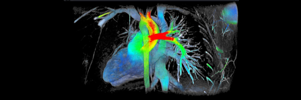 oduct-product-categories-magnetic-resonance-imaging-viosworks-gehc_viosworks-spotlight.jpg