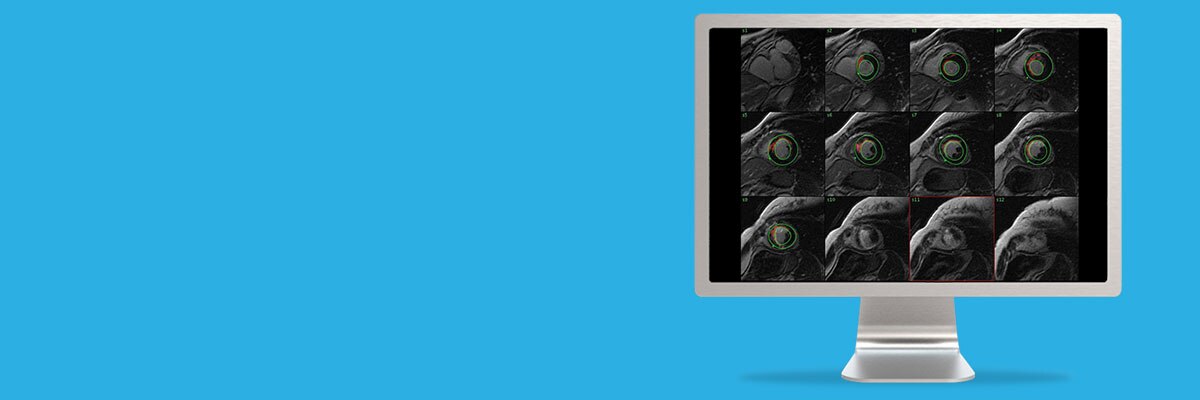 ies-do-not-clone-advanced-visualization-applications-cardiacvx-aw-cardiacvx-spotlight1.jpg