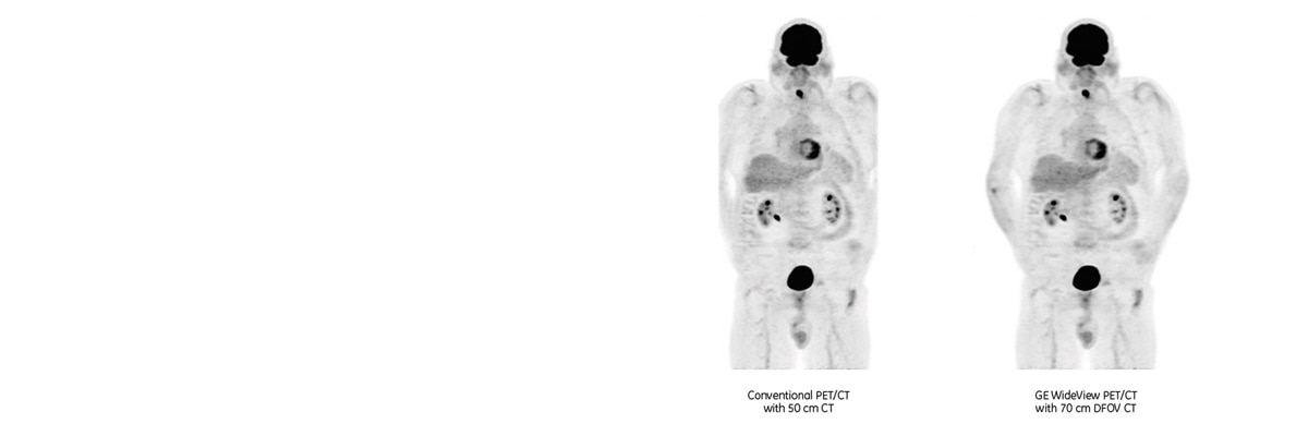 product-product-categories-pet-ct-wideview-discoverypetct600-wideview-comparison.jpg