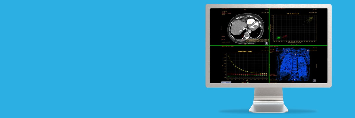 aw-gsi-viewer-spotlight