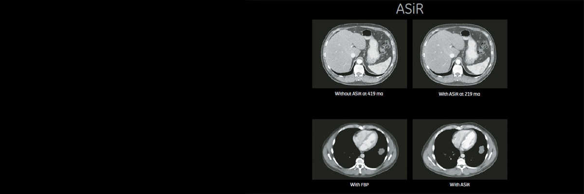 product-product-categories-pet-ct-asir-1-clinical-asir_d690_clinical.jpg