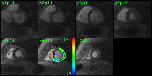 ries-do-not-clone-advanced-visualization-applications-cardiacvx-aw-cardiac-vs_overview_jpg