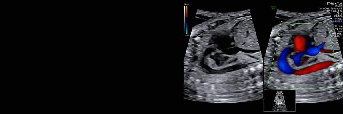 23week_carousel