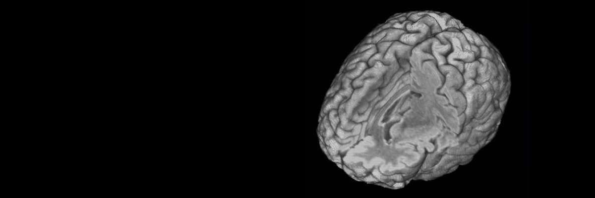CUBE imaging application brain clinical