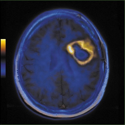 advanced visualization integrated registration.