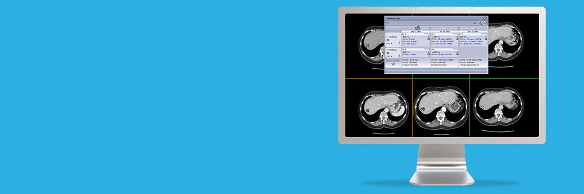 ries-do-not-clone-advanced-visualization-applications-oncoquant-aw-oncoquant-spotlight.jpg
