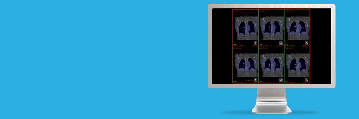 egories-do-not-clone-advanced-visualization-applications-motionvue-spotlight-motionvue.jpg