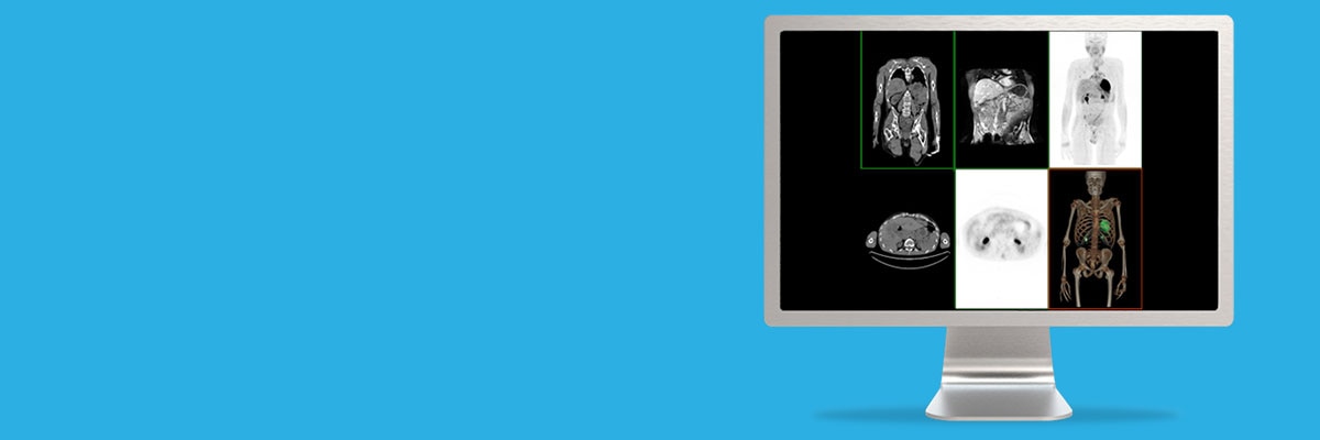 -not-clone-advanced-visualization-applications-volumeviewer-aw-spotlight-volume_viewer.jpg