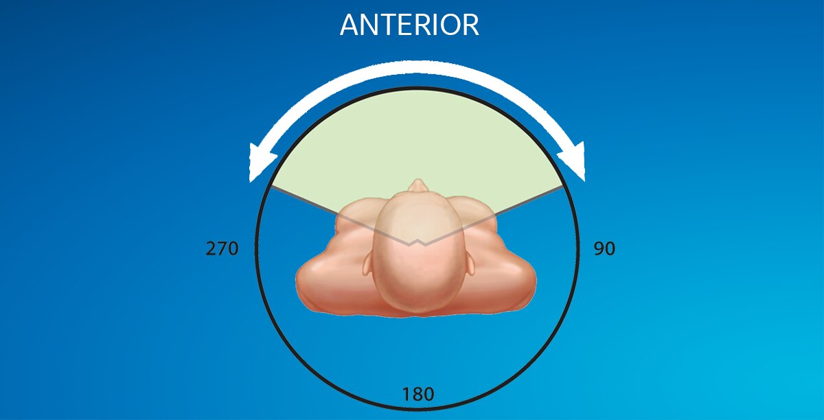 Organ Dose Modulation