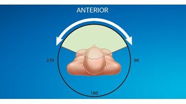 Organ Dose Modulation