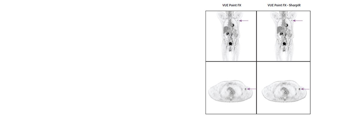 product-product-categories-pet-ct-vue-point-1-clinical-vue_point_fx_sharp_ir_clinical.jpg