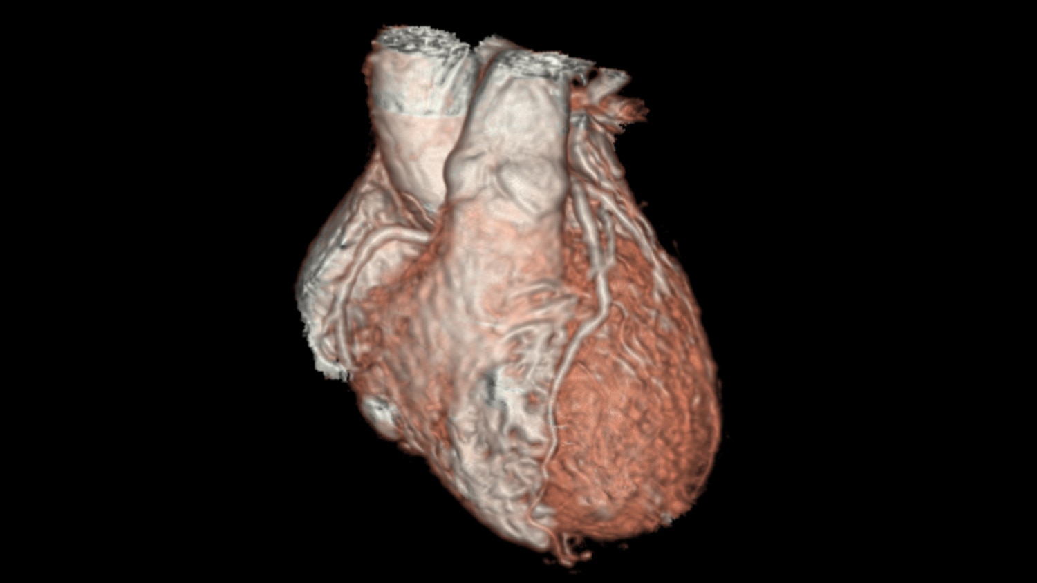 3D heart pediatric imaging clinical