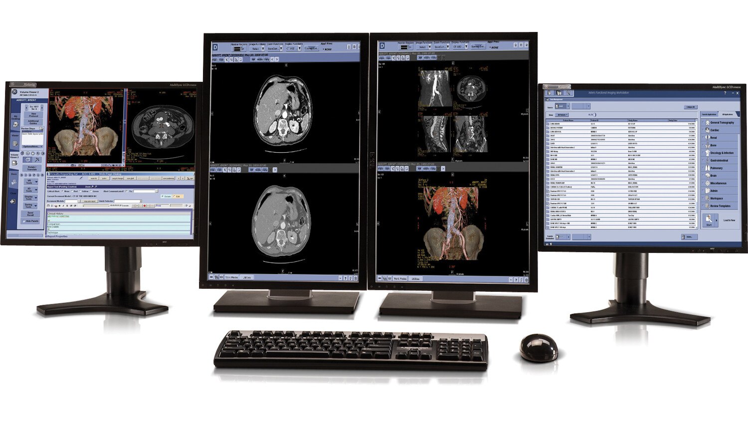 product-product-categories-nuclear-medicine-nuclear_medicine_4monitors.jpg