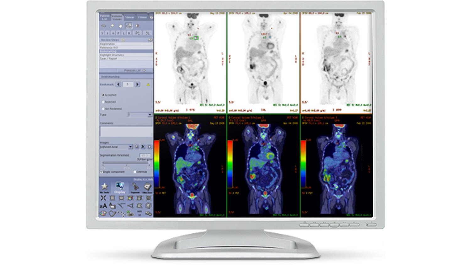 product-product-categories-pet-ct-pet-vcar-petvcar_monitor_image.jpg