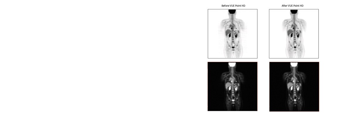 product-product-categories-pet-ct-vue-point-vue_point_hd_before_after.jpg