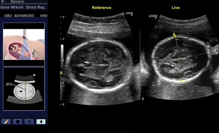 LOGIQ V2 - Accessible Care - Ultrasound - Categories | GE Healthcare