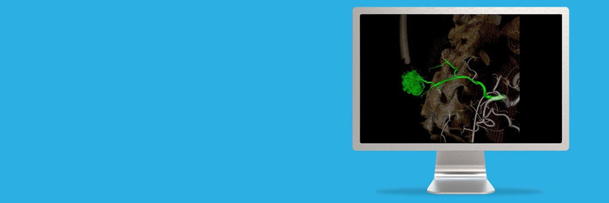 nced-visualization-applications-flightplan-for-liver-aw-flightplan-for-liver_spotlight.jpg
