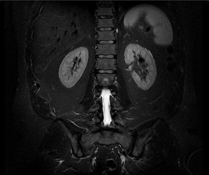 SIGNA™ Artist - 70cm | GE Healthcare