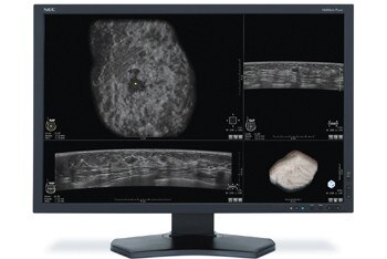 Invenia ABUS Workstation