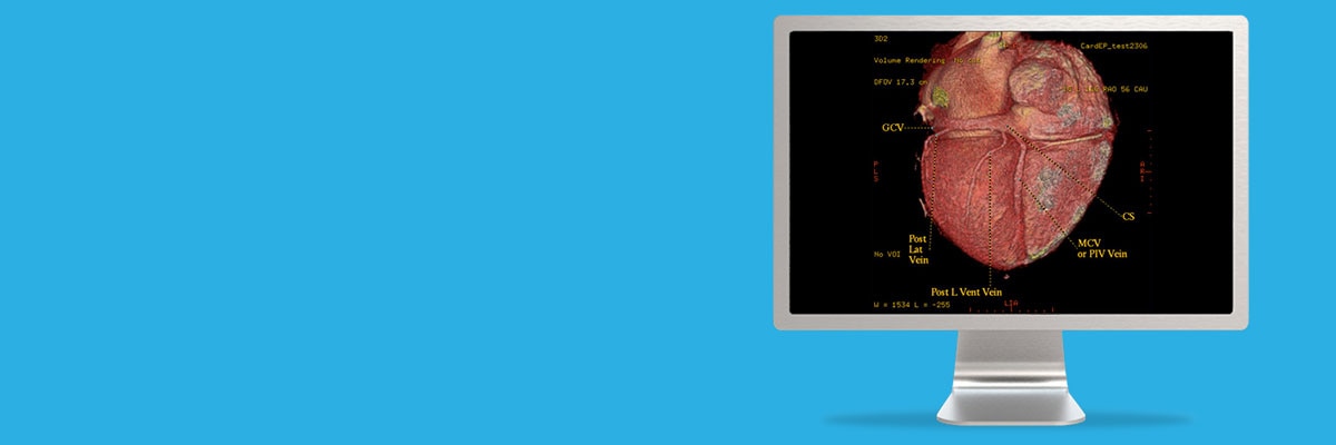 ategories-do-not-clone-advanced-visualization-applications-cardep-aw-cardep-spotlight1.jpg