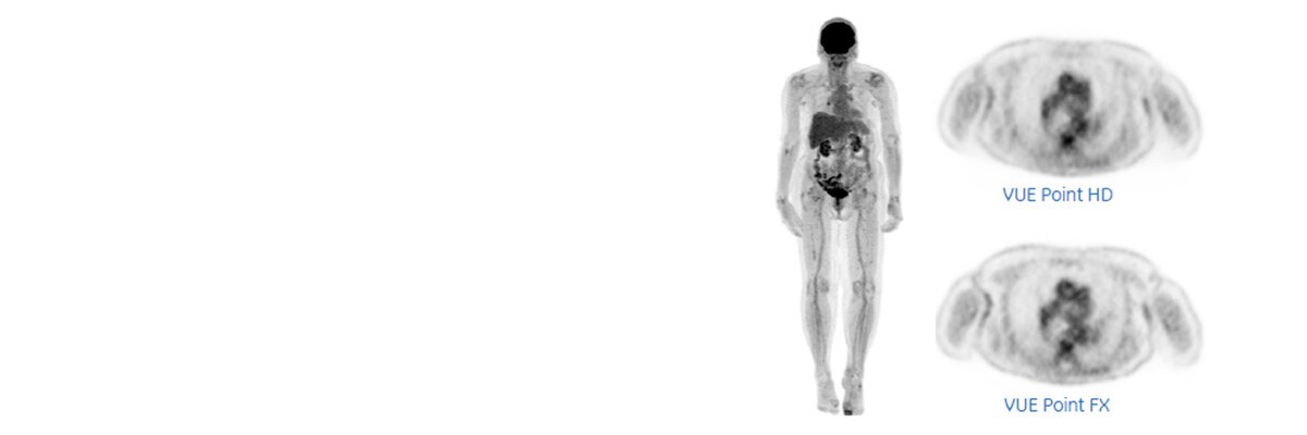product-product-categories-pet-ct-vue-point-1-clinical-vue_point_fx_sharp_ir_clinical3.jpg