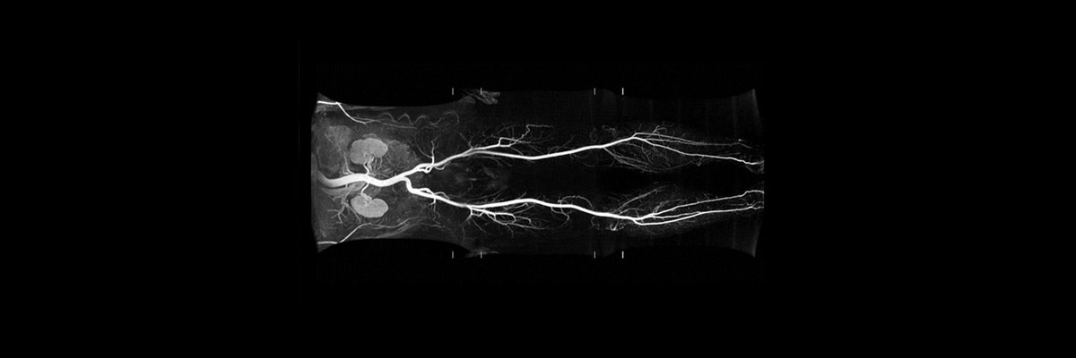 t-categories-magnetic-resonance-imaging-vascular-imaging-quickstep-quickstep_spotlight.jpg