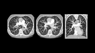 Low-dose PE in 2.67 seconds at full resolution