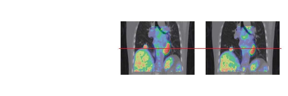 product-product-categories-pet-ct-motion_match_for_web.jpg